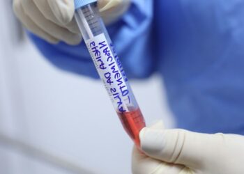 Manaus já enfrenta epidemia de Influenza em meio à pandemia da Covid-19, diz cientista