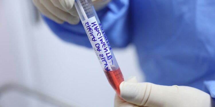 Manaus já enfrenta epidemia de Influenza em meio à pandemia da Covid-19, diz cientista