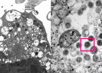 Primeira morte por variante Ômicron da Covid-19 é registrada no Reino Unido