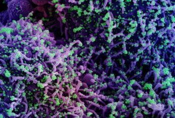 Brasileiro é infectado por Covid e Influenza ao mesmo tempo