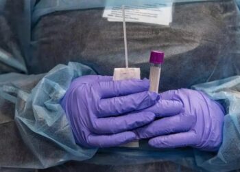 ‘Flurona’ é detectada em duas mulheres no Amazonas