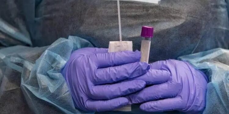 ‘Flurona’ é detectada em duas mulheres no Amazonas