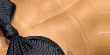 Harmonização corporal das famosas chega em Manaus