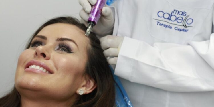 Calvície tem solução com terapias e tratamentos capilares acessíveis