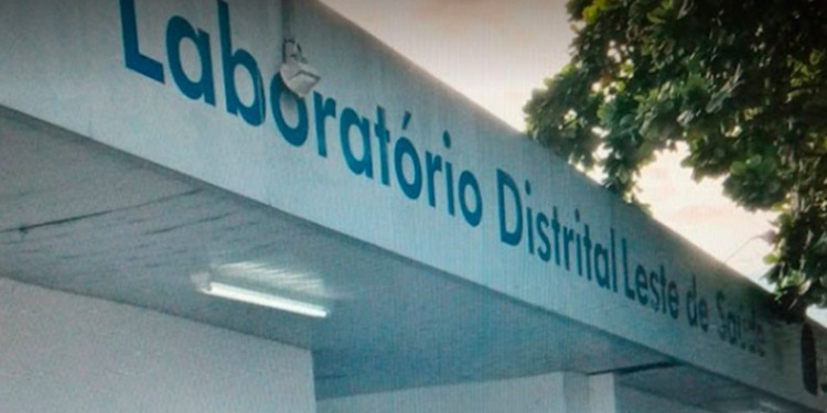 Insegurança: Criminosos furtam Laboratório Distrital Leste e atendimentos são suspensos