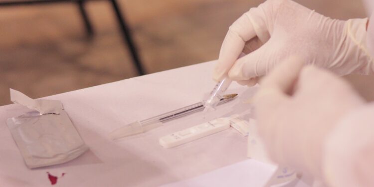 Prefeitura divulga UBSs que realizam testes rápidos para Covid-19 em Manaus