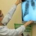 Dia de Combate à Tuberculose: especialista esclarece dúvidas sobre a doença