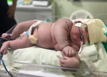 ‘Bebê Gigante’ nasce com mais de 7 kg e 59 cm em maternidade de Parintins,