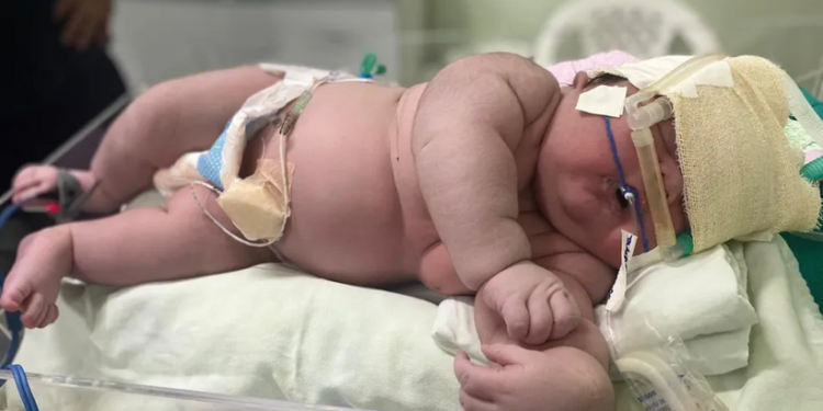 ‘Bebê Gigante’ nasce com mais de 7 kg e 59 cm em maternidade de Parintins,