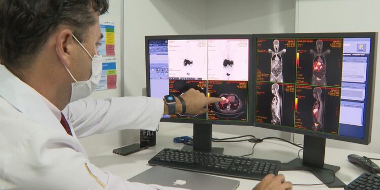 Inca prevê 44 mil casos novos de câncer colorretal no Brasil por ano