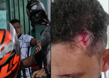 Prefeitura informa que servidores públicos foram agredidos por motociclistas