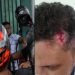 Prefeitura informa que servidores públicos foram agredidos por motociclistas