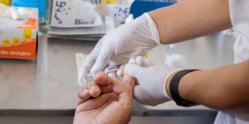 Três Unidades Básicas de Saúde iniciam novo serviço para redução de risco de infecção pelo vírus HIV