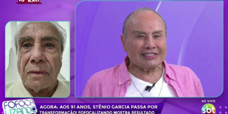 Stenio Garcia mostra resultado de harmonização ao vivo na TV e choca web