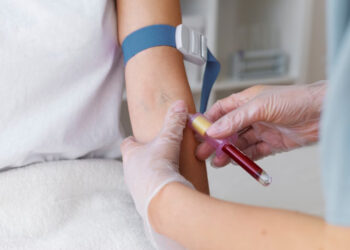 Exames de sangue nem sempre exigem jejum: saiba quando é de fato recomendado