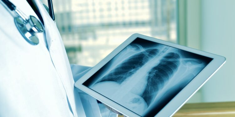 Telerradiologia: tecnologia garante diagnóstico de qualidade para todo Brasil