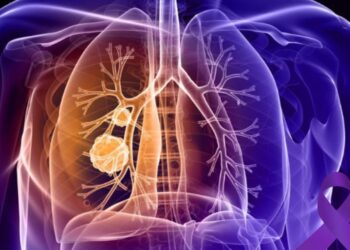 Saiba o que é ‘fibrose cística’, doença que pode ser detectada pelo Teste do Pezinho 