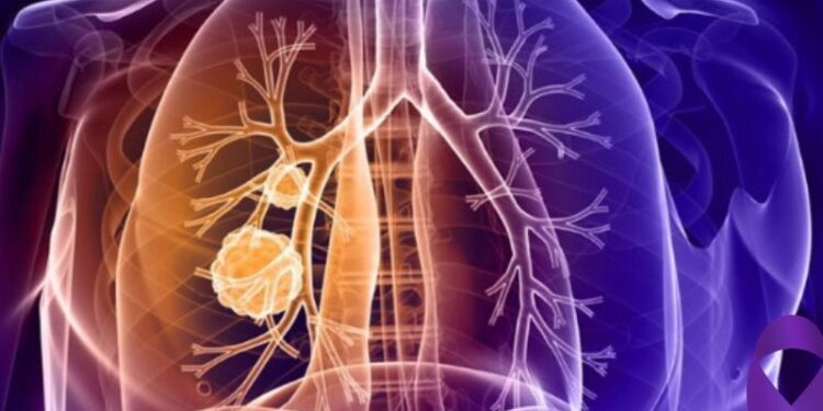 Saiba o que é ‘fibrose cística’, doença que pode ser detectada pelo Teste do Pezinho 