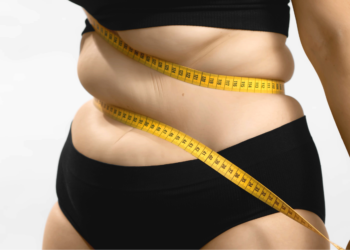 Obesidade: mudança de hábitos e estilo de vida pode combater a doença