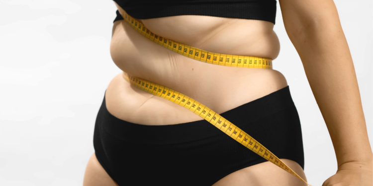Obesidade: mudança de hábitos e estilo de vida pode combater a doença