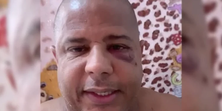 Com sinais de agressão, Marcelinho Carioca grava vídeo sobre sequestro