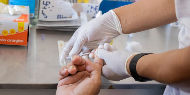 Manaus amplia número de unidades de saúde que ofertam profilaxia pré-exposição ao HIV