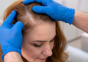Dermatologista Maria de Fátima Maklouf explica o que e como tratar a alopecia