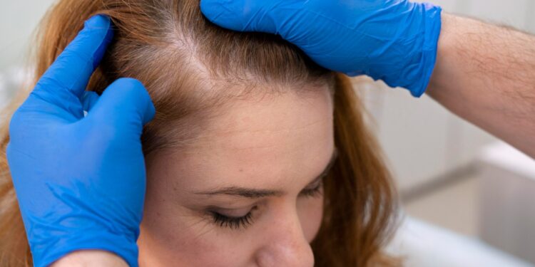 Dermatologista Maria de Fátima Maklouf explica o que e como tratar a alopecia