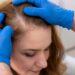 Dermatologista Maria de Fátima Maklouf explica o que e como tratar a alopecia