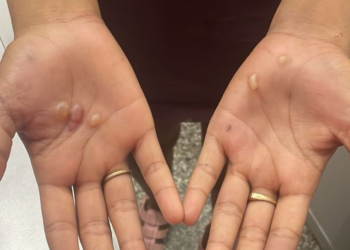 Mulher tortura e ameaça atear fogo em adolescente no Amazonas, diz polícia