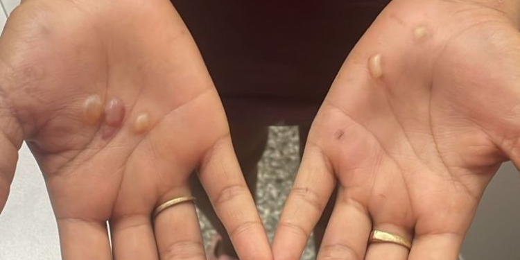 Mulher tortura e ameaça atear fogo em adolescente no Amazonas, diz polícia