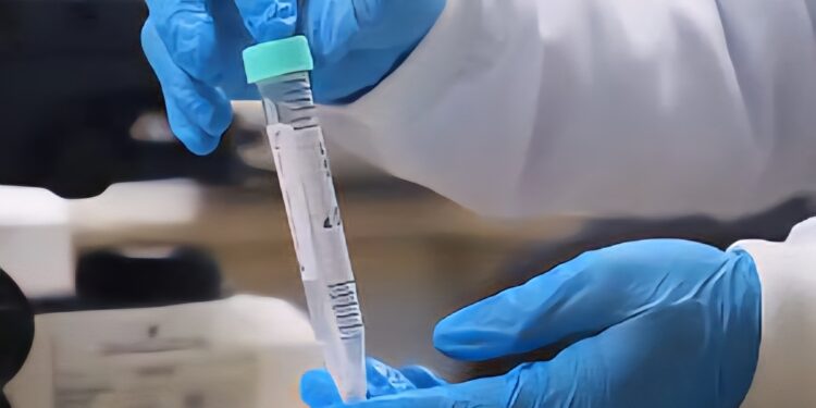 Fundação registra redução de casos de mpox no Amazonas
