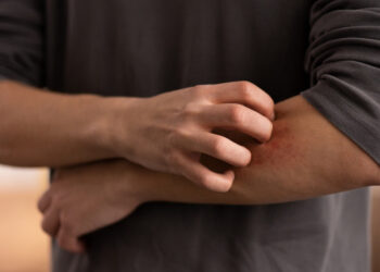 Dia Mundial contra os Mosquitos acende alerta para prevenção a doenças tropicais