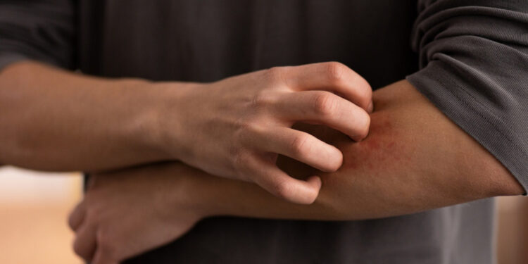 Dia Mundial contra os Mosquitos acende alerta para prevenção a doenças tropicais