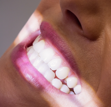 Procura por lentes de contato dentais cresce em consultórios; saiba se esse procedimento é adequado para você